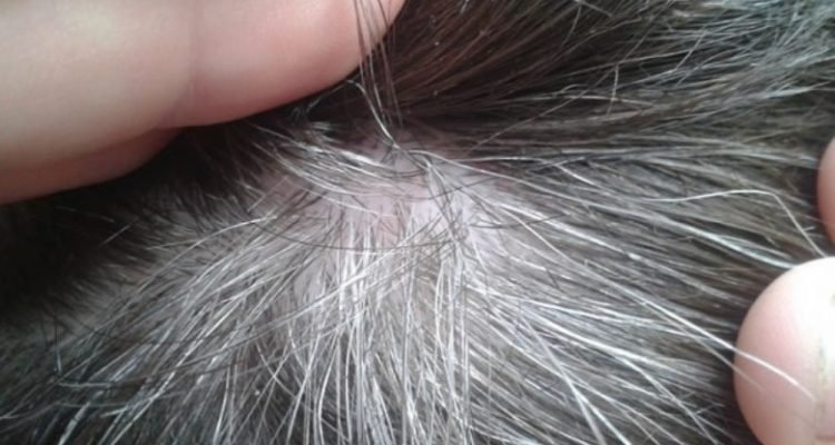 bicarbonato-no-cabelo-2
