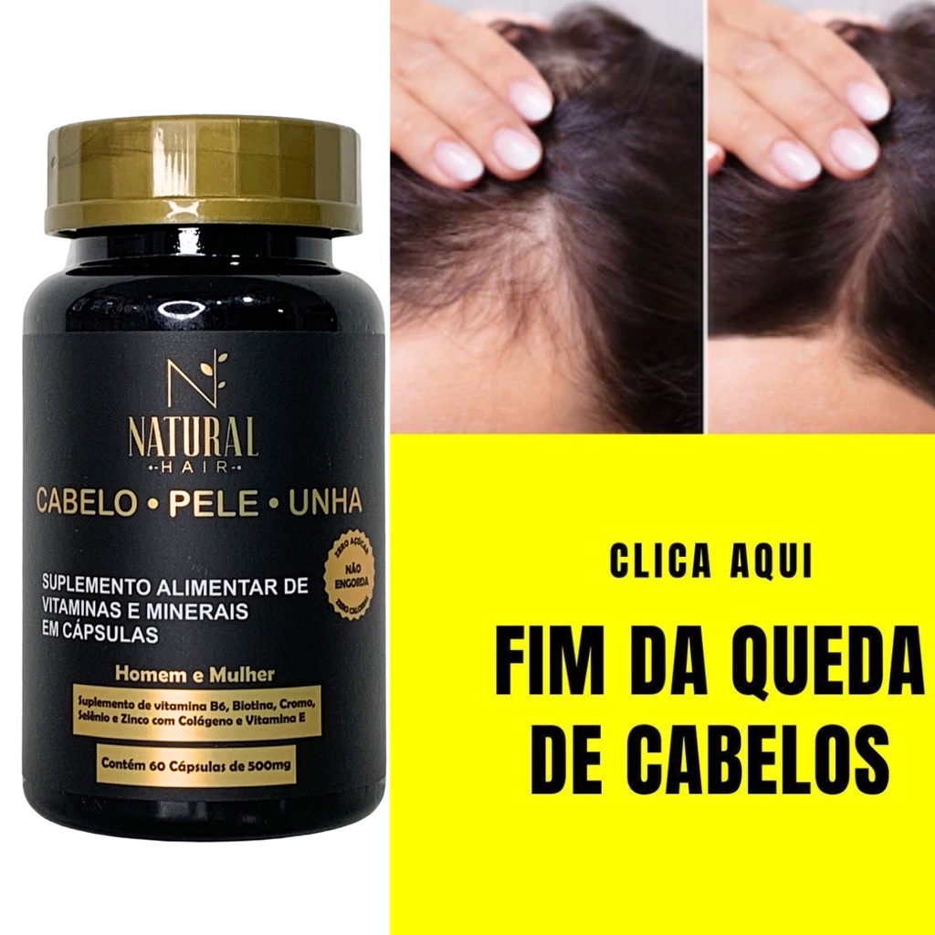 vitamina-para-queda-de-cabelo-feminino